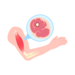 Musculoskeletal Pain Icon