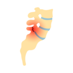 Sciatica Icon