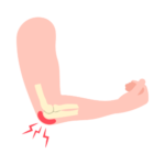 Soft Tissue Pain Icon